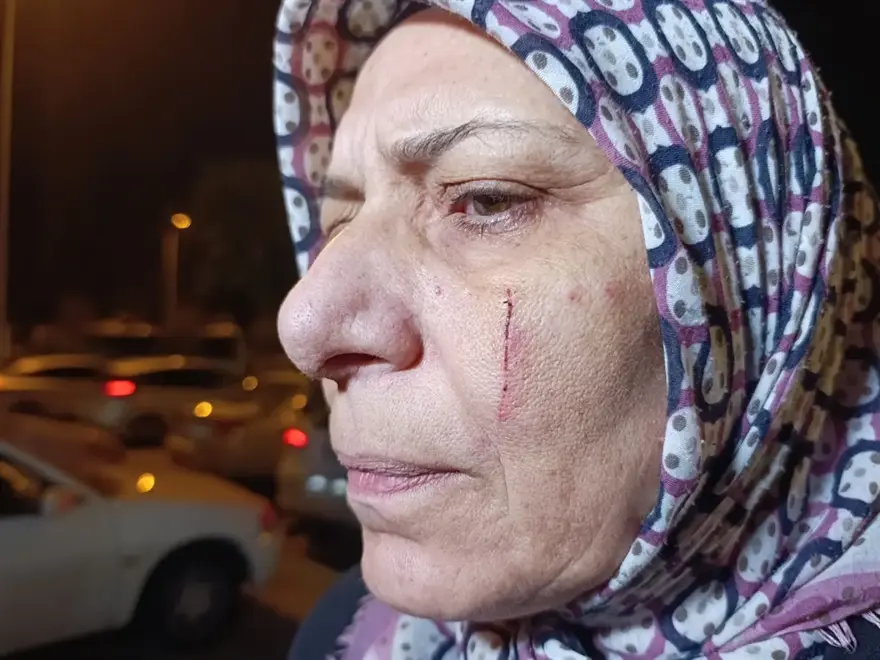 BABANIN DİŞLERİ KIRILDI, ANNE İLE OĞLU BIÇAKLANDI 1