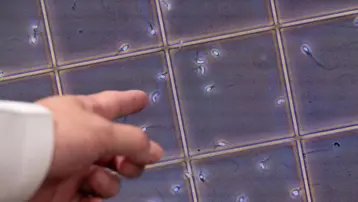 17 yıl sperm bağışladı, doğan bebeklerin 10'u kanser, bazıları öldü