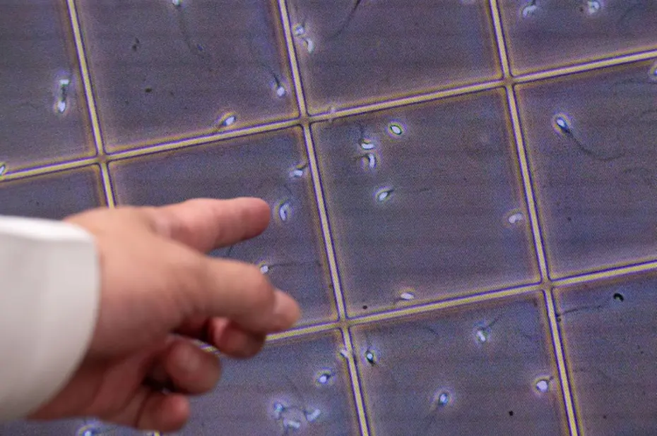 17 yıl sperm bağışladı, doğan bebeklerin 10'u kanser, bazıları öldü