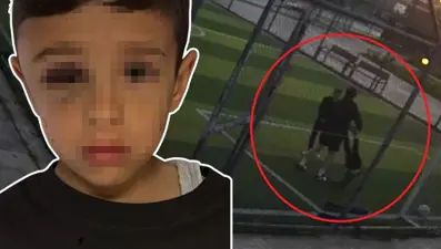 Yine akran zorbalığı: Sallanıp yere fırlatılan Güney beyin kanaması geçirdi