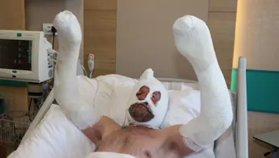 Benzin bidonu sonu oluyordu: “Olayınetkisinden kurtulamıyorum, rüyama giriyor”