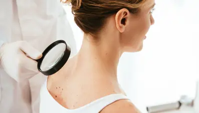 24 yaşındaki kadın basit bir halsizlik yaşadığını sanıyordu: Aylar sonra cilt kanseri olduğunu öğrendi