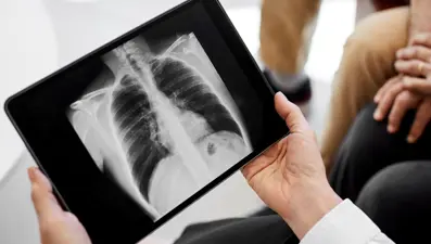 Covid-19'un neden olduğu pıhtı böyle öldürüyor