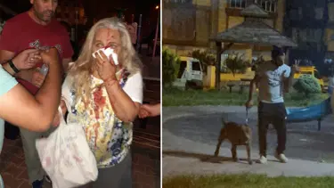 55 yaşındaki kadın çocuk parkında pitbulların saldırısına uğradı