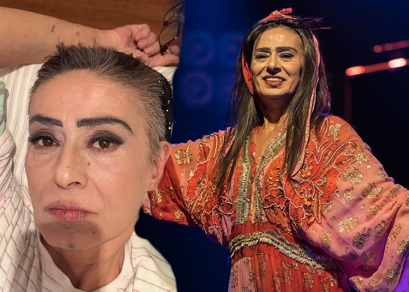 Yıldız Tilbe saçlarını kısacık kestirdi: "Yaralarım geçmeyecekti"