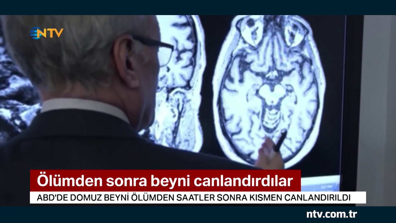 Ölümden sonra beyni canlandırdılar