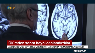 Ölümden sonra beyni canlandırdılar