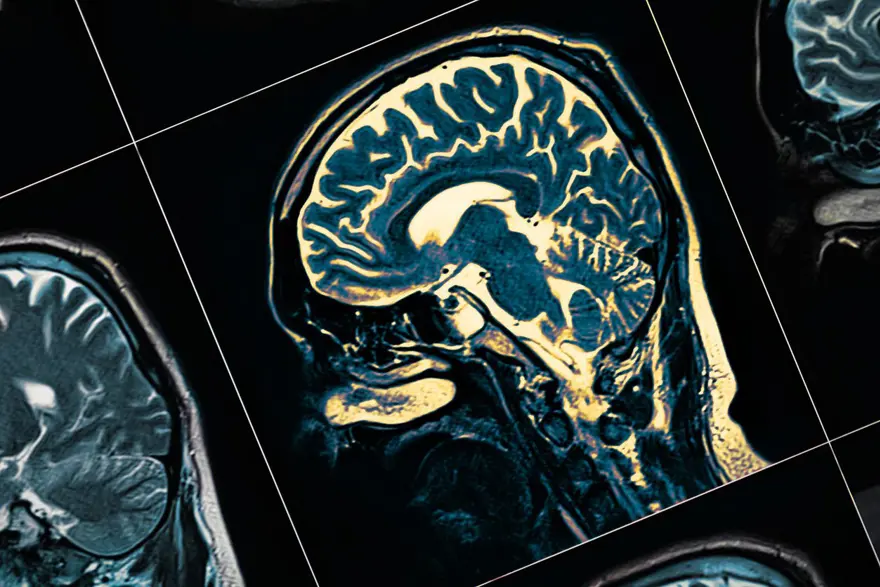 Alzheimer'ın en erken belirtisi uykuda ortaya çıkıyor: Çinli bilim insanları tehlikeyi kanıtladı 1