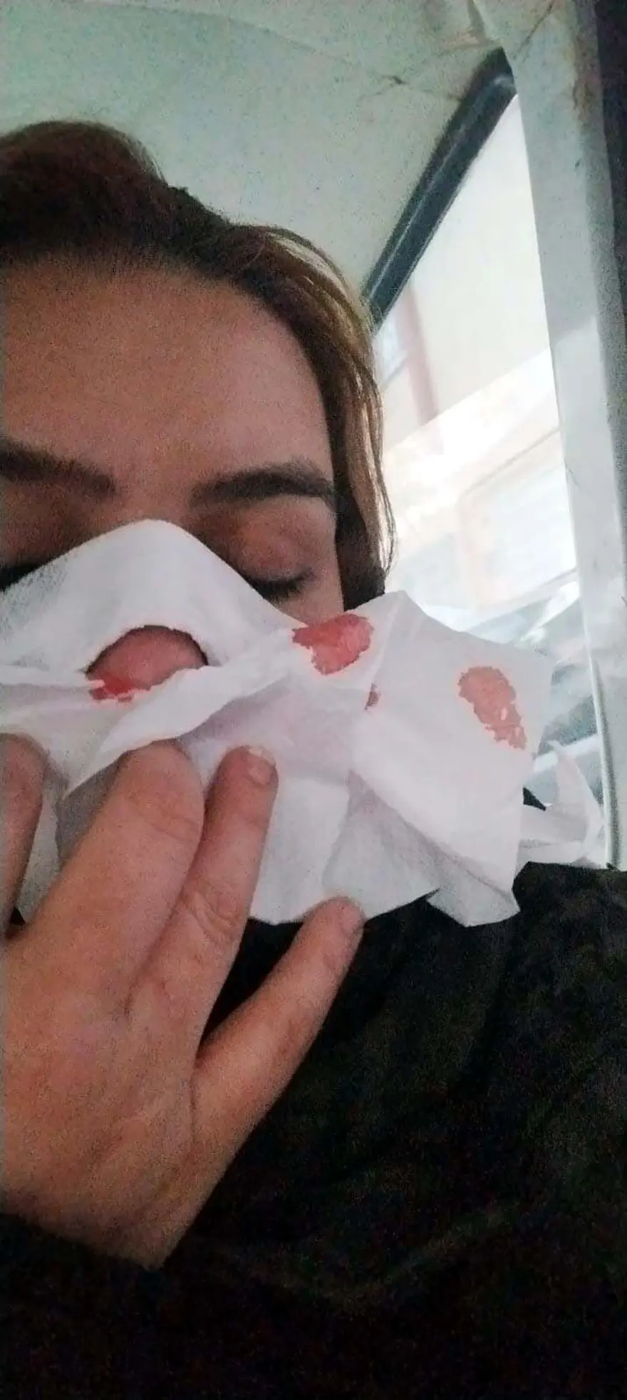 "'ÖLÜMÜNE VURUN' DİYORLARDI" 3