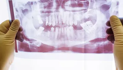 “Türkiye’nin yüzde 70’inde çene eklem rahatsızlığı var”