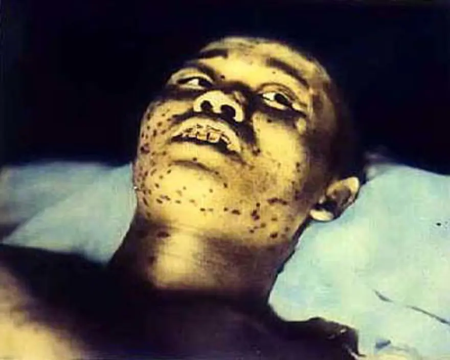 İnsanlığın kaybettiği yer: Hiroşima 10 İnsanlığın kaybettiği yer: Hiroşima 10