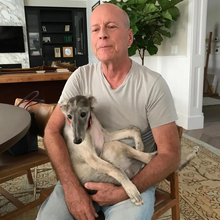 Bruce Willis'in kızı Tallulah Willis babasının son durumunu açıkladı 