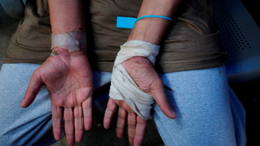 İsrail'in alıkoyduğu Filistinli Doktor: "Elleri ayakları olmayanlar bile işkenceden kaçamadı"