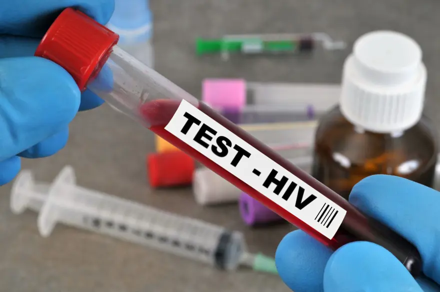 HIV-AIDS salgını 7