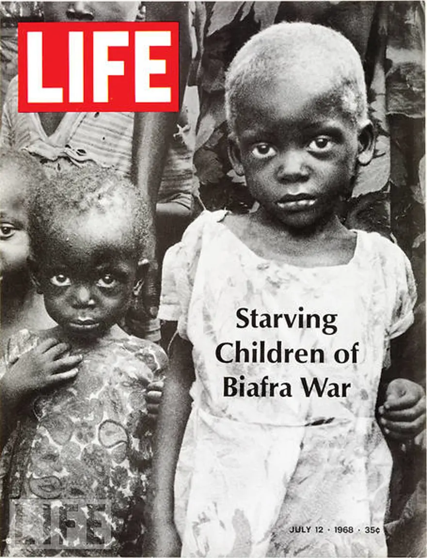 Biafra'daki aç çocuklar 62