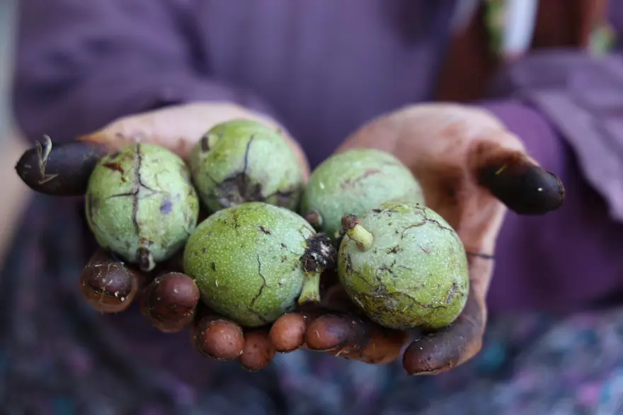 74 yaşındaki Dursun nine şeker hastalığını böyle yendi: Doktoru tavsiye etmiş 1