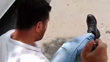 Bacaklarından vurup sosyal medyada paylaştı, tutuklandı