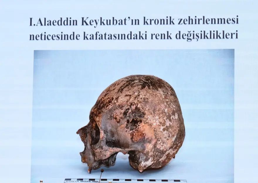 Selçuklu sultanlarının DNA analizi yapıldı: Hastalıkları ve ölüm nedenleri belirlendi 2