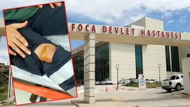 Sağlık çalışanının dizine makas sapladı