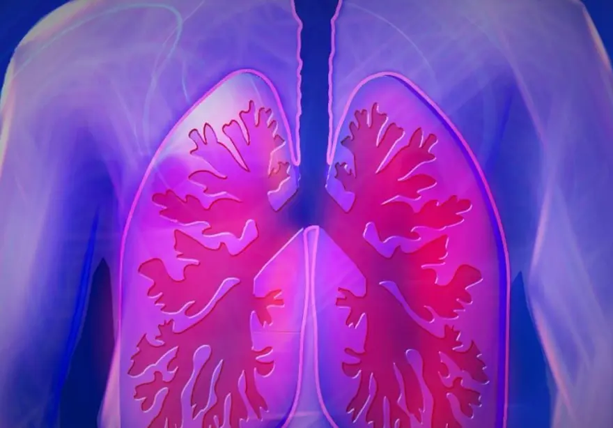 ASBESTİN NEDEN OLDUĞU HASTALIKLAR 3