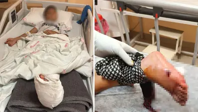 Balkonda oturan çocuğa kurşun isabet etti