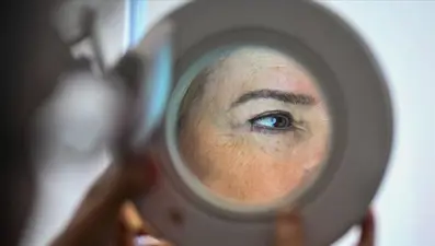 Tarihin en yüksek seviyesi: İngiltere'de cilt kanseri vakaları yılda 17 bin 500'e çıktı