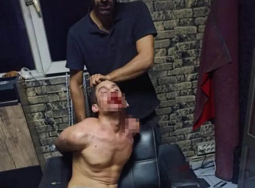 “PARMAK UÇLARIMA ELEKTRİK VERDİLER” 6