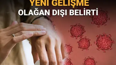Dünyayı sarsan HMPV'de yeni gelişme: Olağan dışı belirti tespit edildi