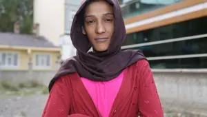 Boyu 2 metre olan genç kız tedavi olmak istiyor (Hermafrodit hastalığı nedir?)