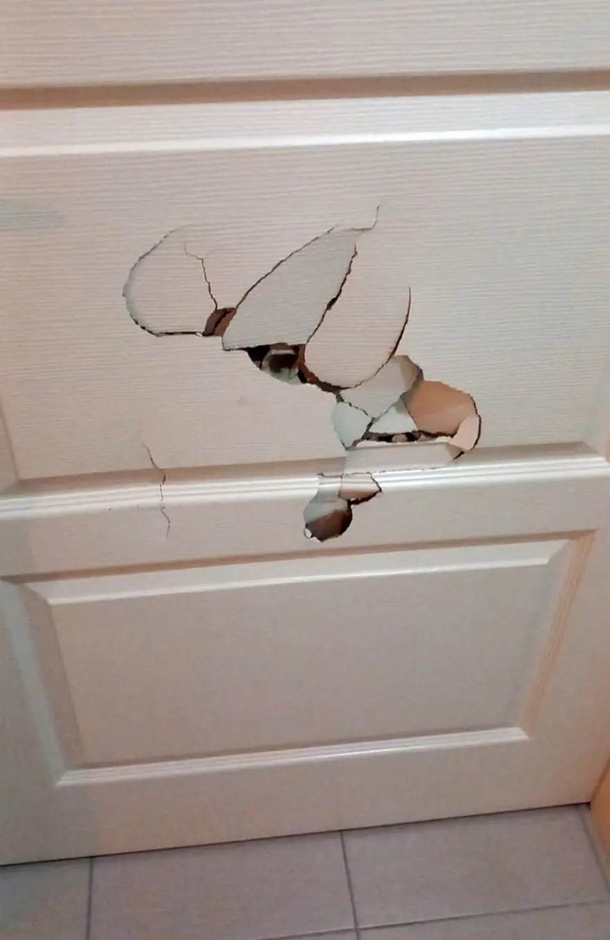 Ameliyatta karnında unuttukları iğne kabusu oldu! Eşi, bebek sahibi olamadığı için dövdü 3