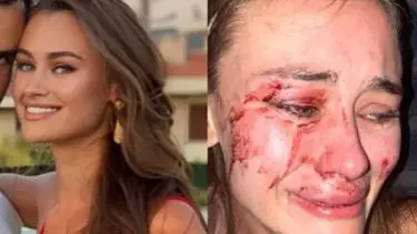 Bakan Ersoy'dan Çeşme'de darp edildiğini öne süren model Daria Kayriliyuk ile ilgili açıklama