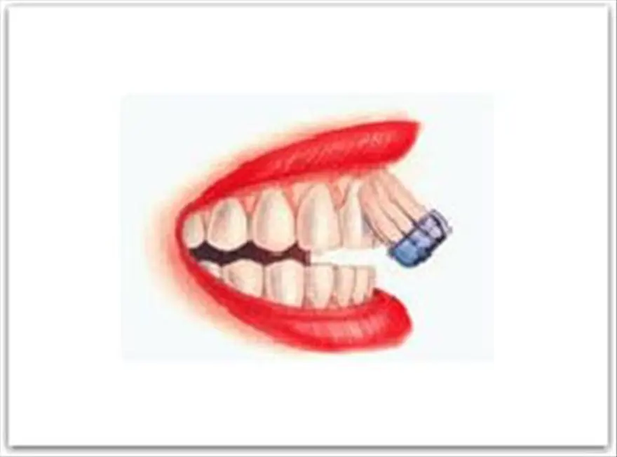 Doğru diş fırçalama teknikleri Doğru diş fırçalama teknikleri