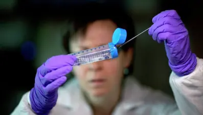 Ankara Valiliğinden şarbon açıklaması