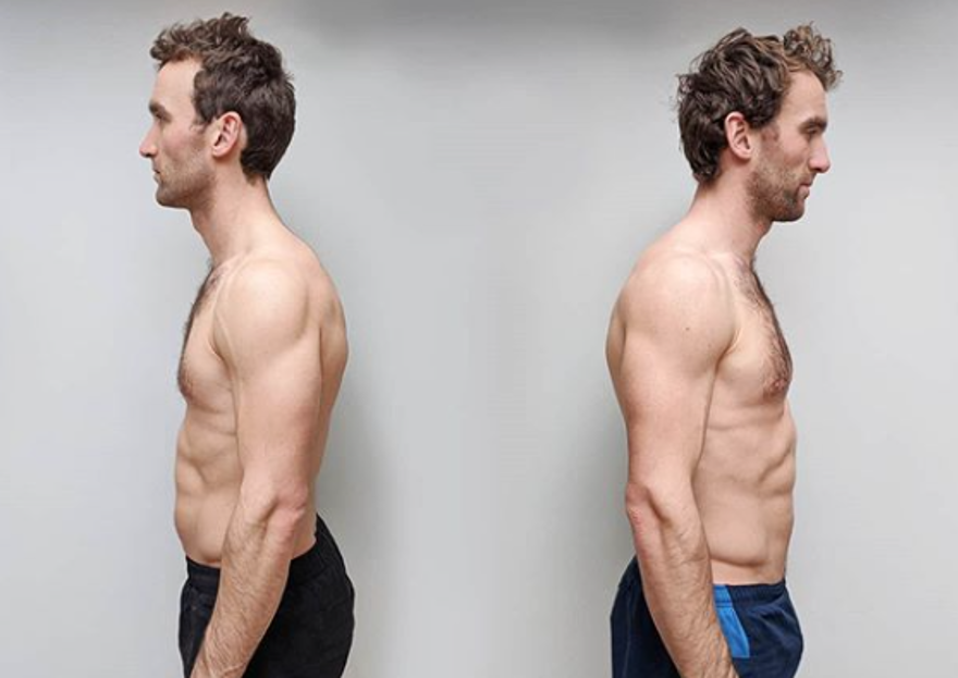 Vegan ve etle beslenen ikiz kardeşler arasında çarpıcı farklar ortaya çıktı 1 Vegan ve etle beslenen ikiz kardeşler arasında çarpıcı farklar ortaya çıktı 1