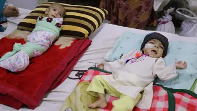 İnsanlık dramı: Sütten kesilen Afgan annelerin bebekleri büyüyemiyor