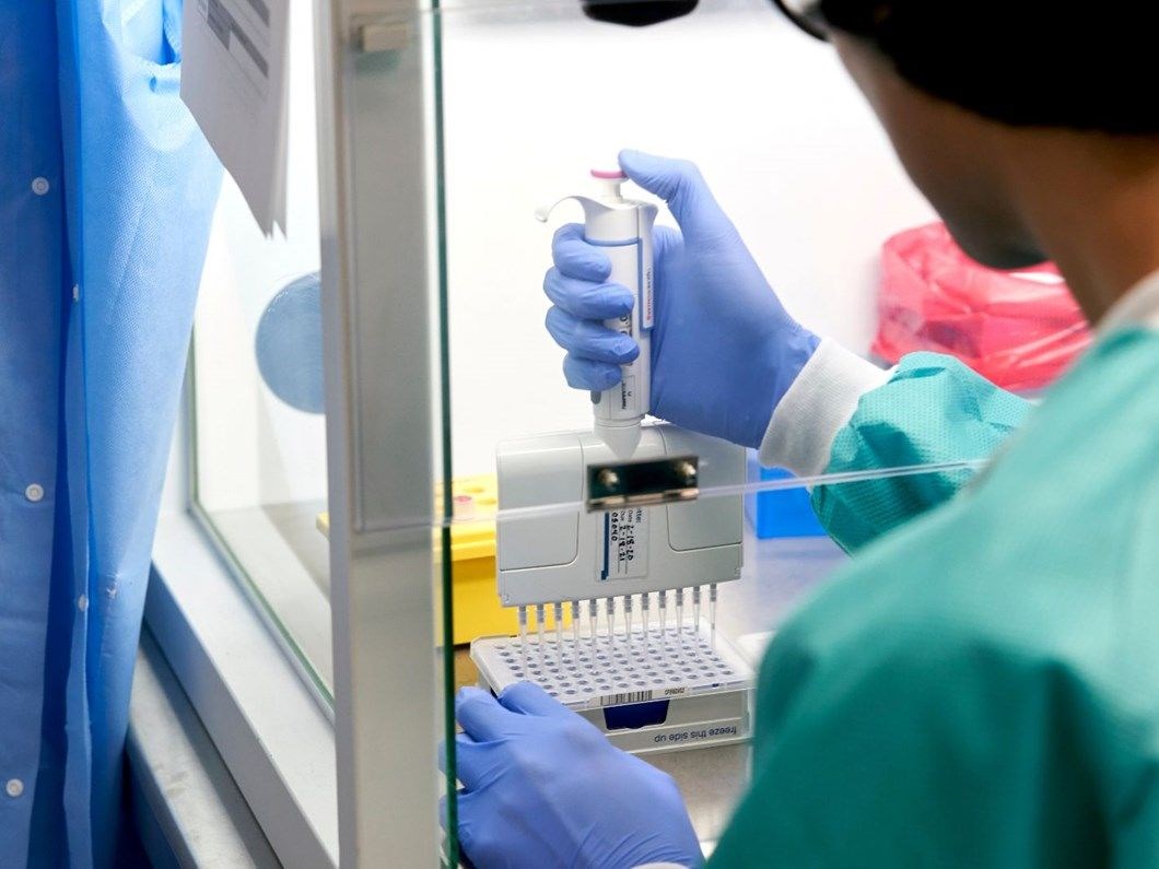 Özel hastaneler için yeni ödeme modeli: PCR testi sonucu pozitif çıkan hastanın tedavisi için devletten ödenek alınabilecek
