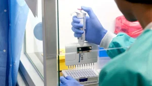 Özel hastaneler için yeni ödeme modeli: PCR testi sonucu pozitif çıkan hastanın tedavisi için devletten ödenek alınabilecek Özel hastaneler için yeni ödeme modeli: PCR testi sonucu pozitif çıkan hastanın tedavisi için devletten ödenek alınabilecek