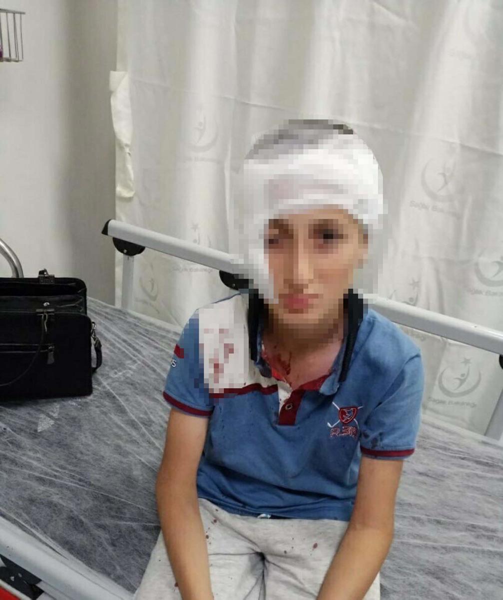 11 yaşındaki çocuğa köpek saldırısında 1,2 milyon lira tazminat kararı