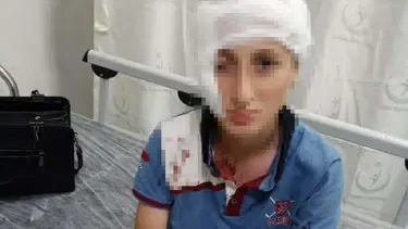 11 yaşındaki çocuğa köpek saldırısında 1,2 milyon lira tazminat kararı