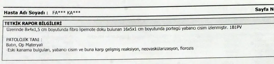 Karnında makas unutuldu,  7 yıl sonra böyle ortaya çıktı: "Mucize eseri hayatta kalmışım" 2