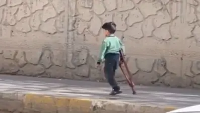 Sosyal medyada çok konuşulmuştu: 3 yaşındaki Muhammet'e protez bacak