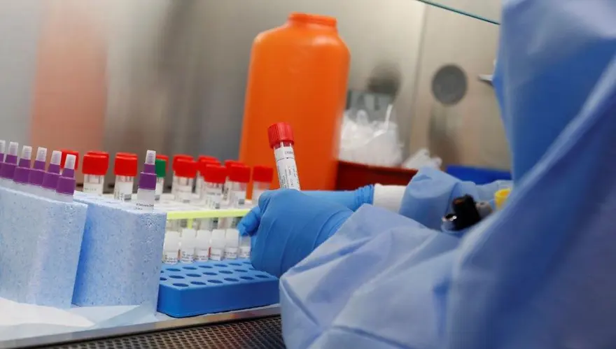 ERMENİSTAN'DA 239 YENİ VAKA 5 ERMENİSTAN'DA 239 YENİ VAKA 5