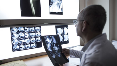 Meme kanserinde çığır açan buluş: "Akıllı bomba" tümörü yok edecek