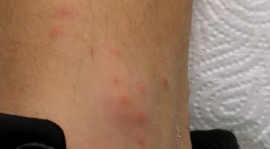 İstanbul'da 'Aedes' cinsi sivrisinekle mücadele 5