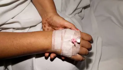 Acil durum ilan edildi! Dang humması vakaları 3 kat arttı, ölümcül olabilir