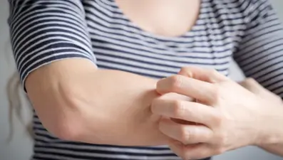 Genellikle egzamayla karıştırılıyor! Kanserin en sinsi belirtisi: Harvardlı uzmanlar uyardı