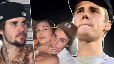 Justin Bieber'ın yüzündeki değişim hayranlarını endişelendirdi