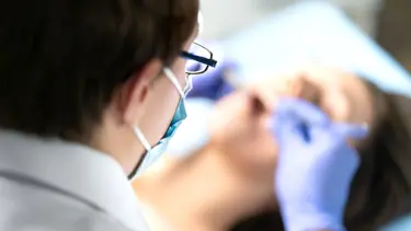 Polikistik over sendromu hastası kadının diş etlerinde kıllar çıktı