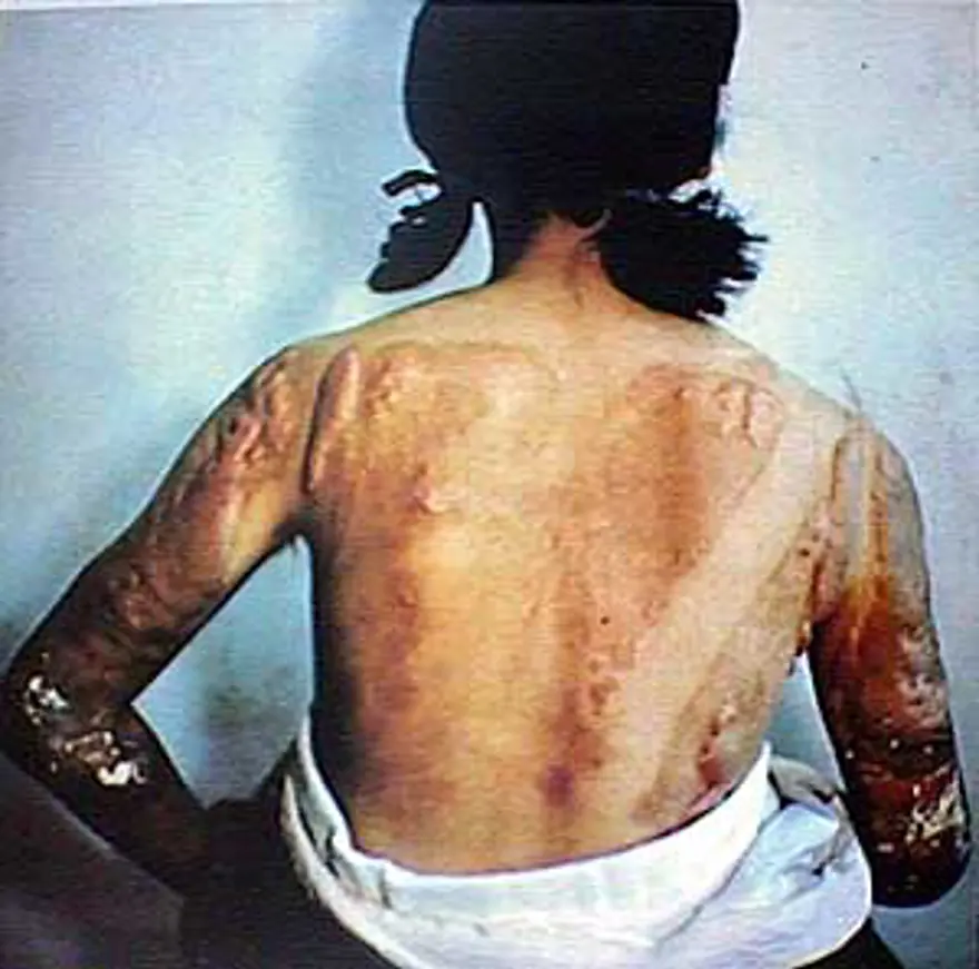 İnsanlığın kaybettiği yer: Hiroşima 20 İnsanlığın kaybettiği yer: Hiroşima 20