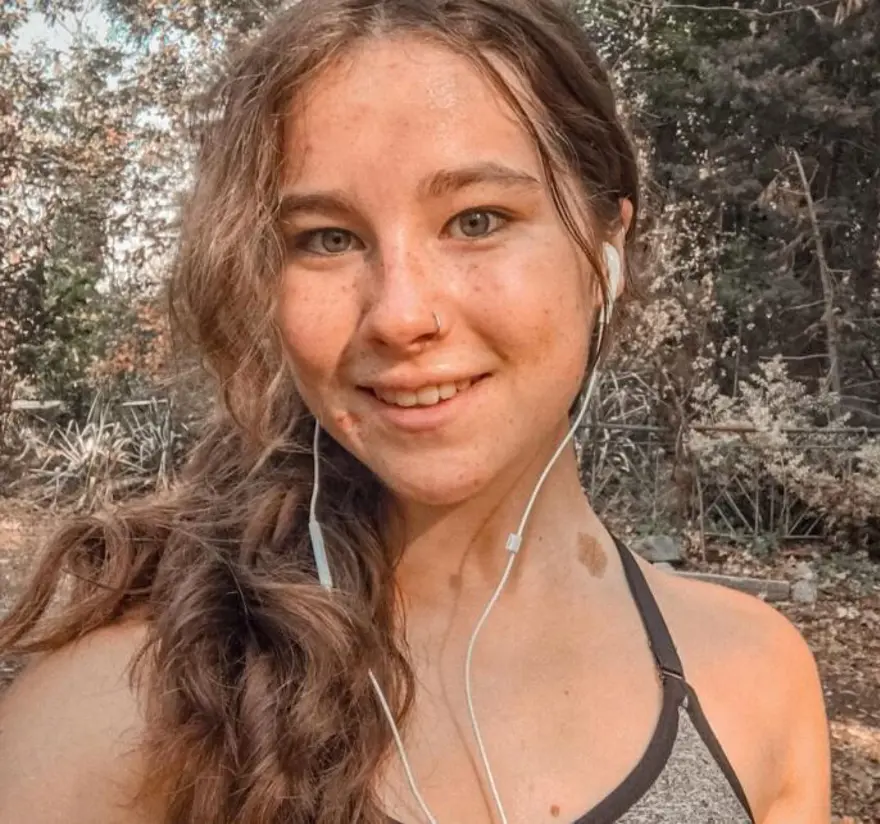 Saçlarını 1 yıldır yıkamıyor: Ailem ve arkadaşlarım deli olduğumu düşünüyor 2